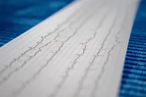Journée de sensibilisation sur l'insuffisance cardiaque